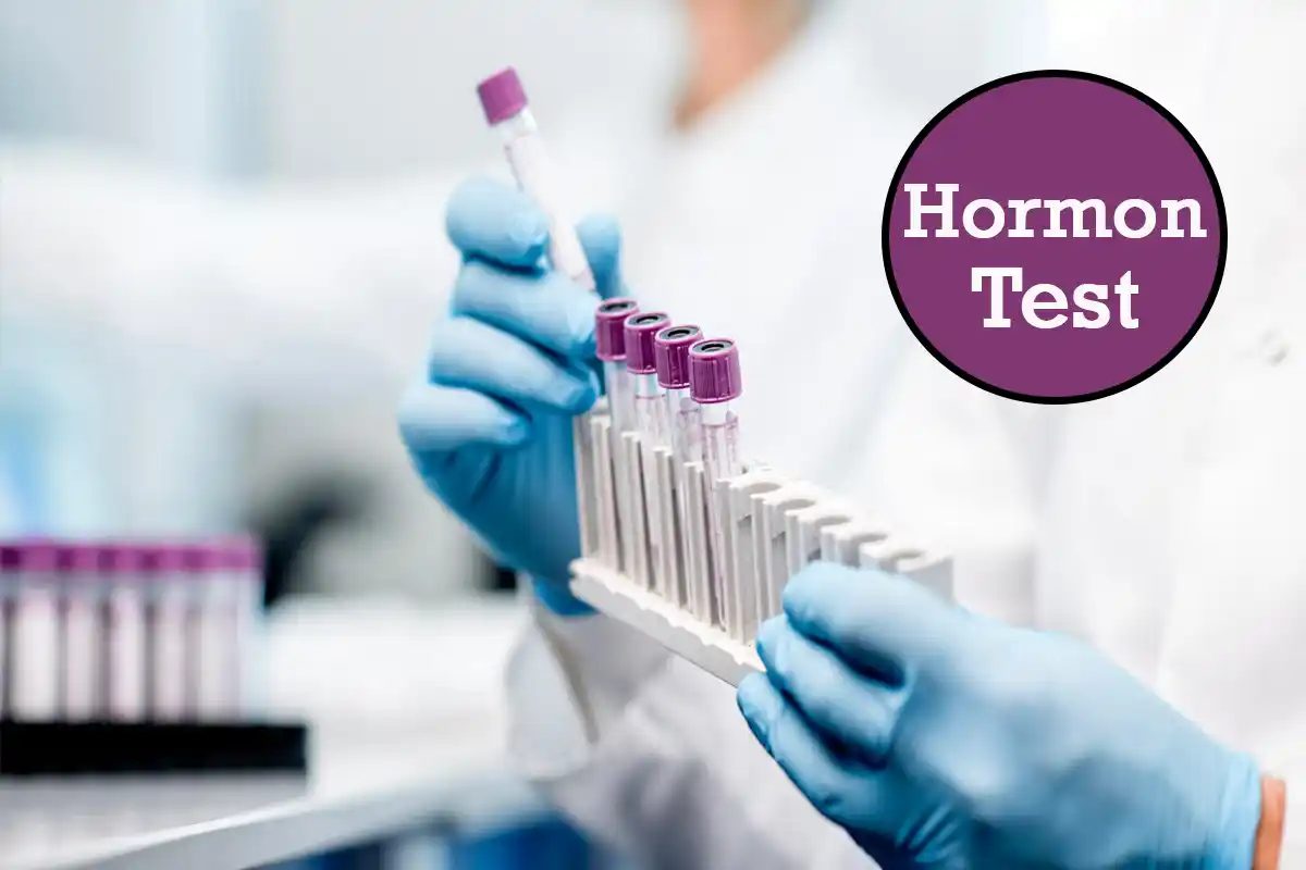 What is a Hormone Test? When to Do The Hormone Test?